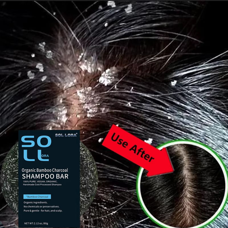Fast Anti Dandruff Hair Treatm - Castor Oil Soap のレビューと価格