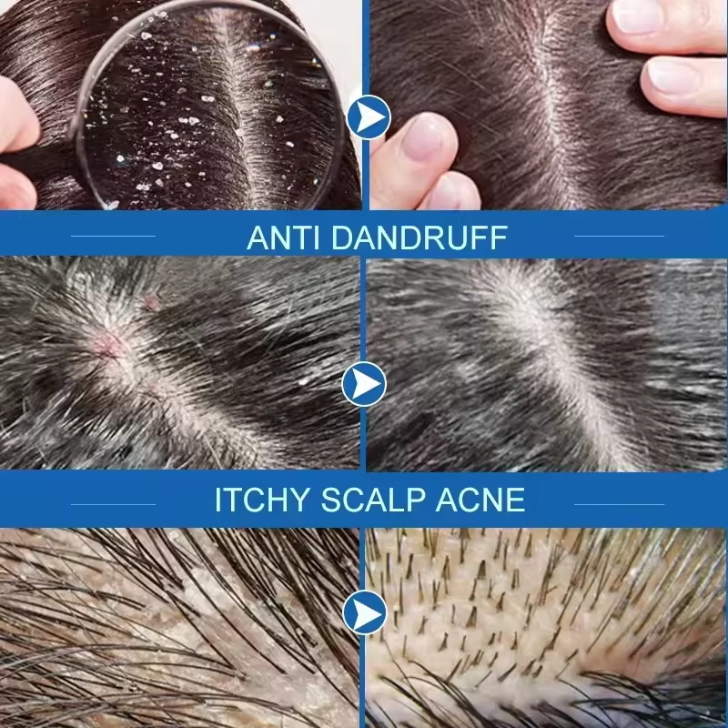 Fast Anti Dandruff Hair Treatm - Castor Oil Soap のレビューと価格
