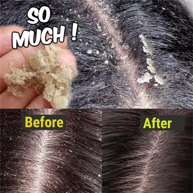 Fast Anti Dandruff Hair Treatm - Castor Oil Soap のレビューと価格